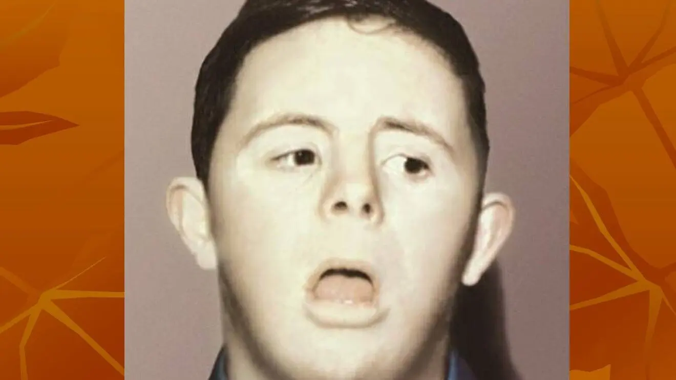 Олигофрения